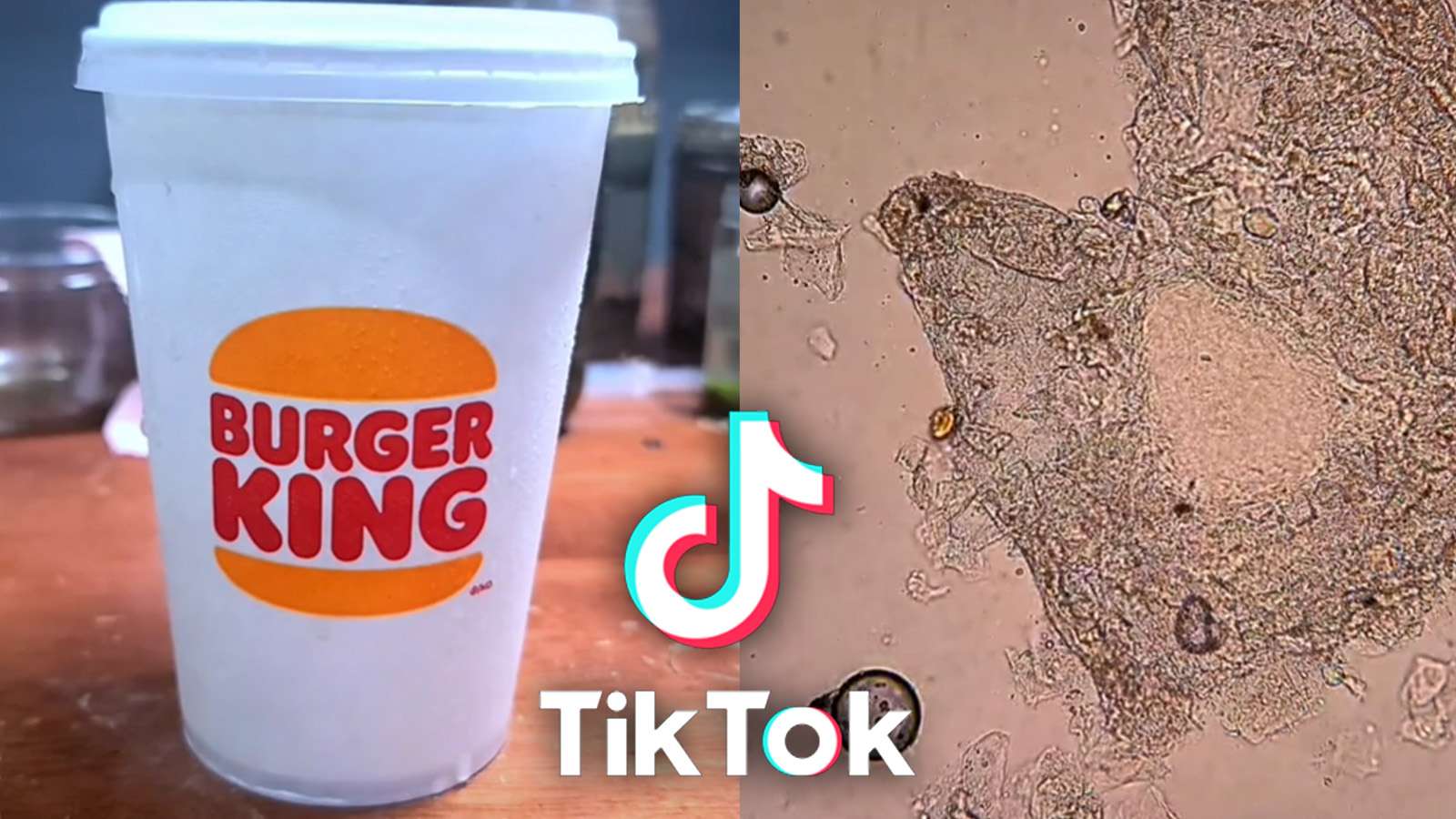 Burger King cup beside what it looks like under the microscope