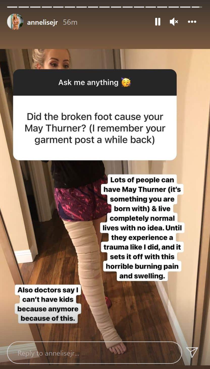 Annelise Marie on vlog squad broken foot