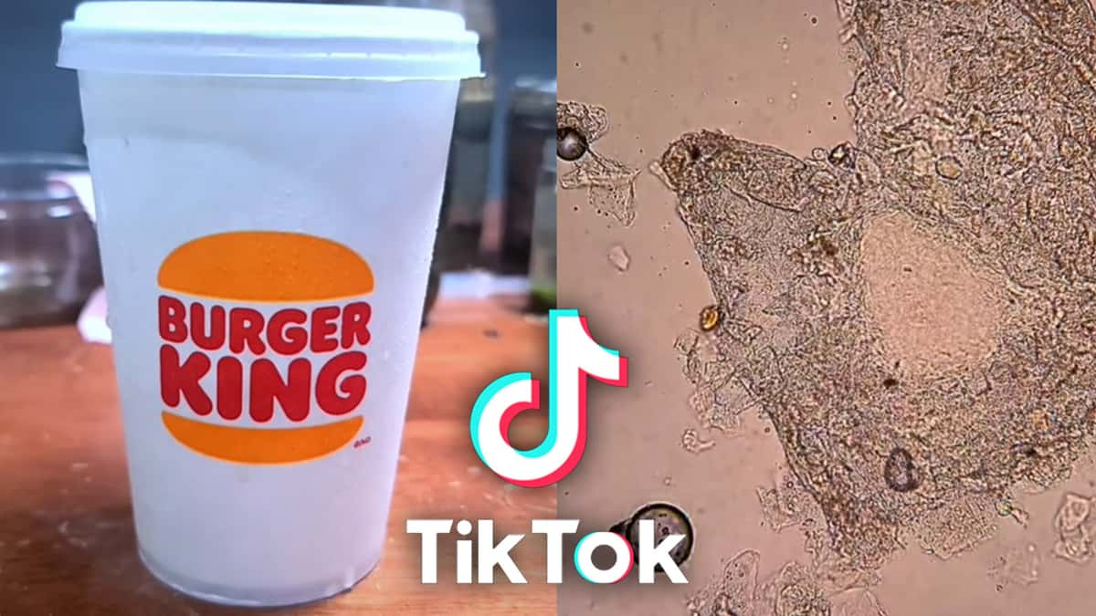 Burger King cup beside what it looks like under the microscope