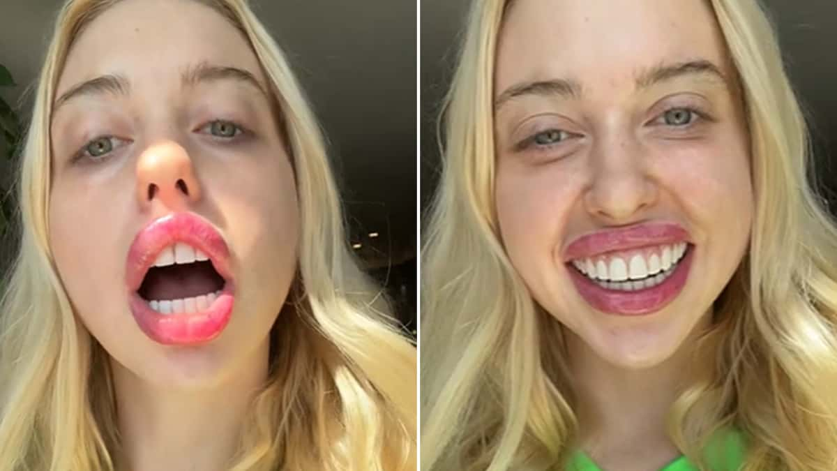 chloe-cherry-under-fire-new-tiktok-teeth