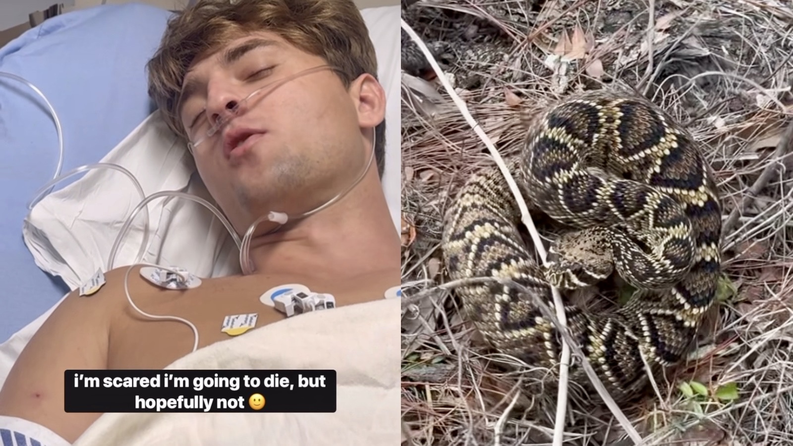 Influencer bit by venomous snake gets 88 vials of antivenom to save his life